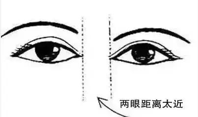 什么人合适开内眼角和外眼角,每个人都合适开外眼角吗