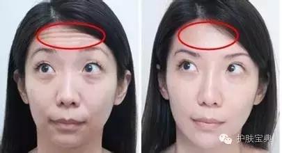 女生会在意男生的抬头纹,有一天突然发现自己有了抬头纹