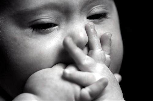 后期发现宝宝是唐氏综合征,唐氏综合征会长胖吗