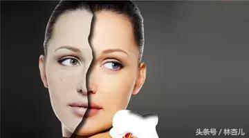 脸上长斑怎么办六个祛斑小妙招,脸长斑有什么方法祛斑