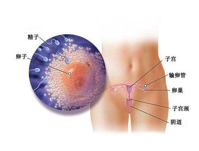 女性宫颈炎有哪些症状表现,女性得宫颈炎有什么表现