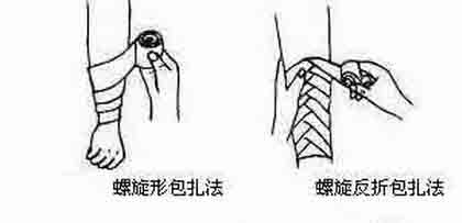 外伤急救的注意事项,急救知识伤口少量出血怎么处理