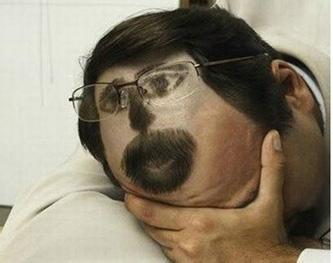 脱发怎么拯救自己的头发,怎样从脱掉的头发根辨别脱发原因