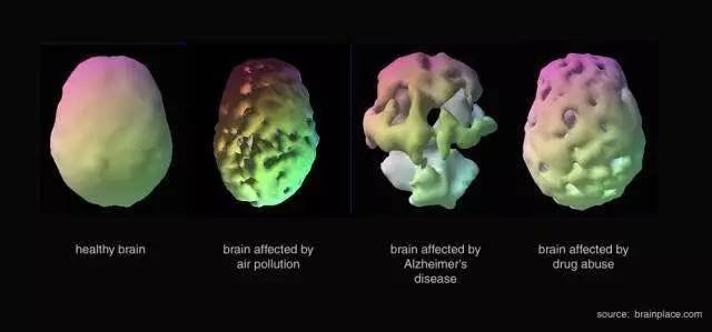 儿童顽固性咳嗽行家,雾霾天气孩子咳得厉害怎么弄