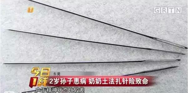 儿童针眼治疗土方法,1岁宝宝起针眼最快解决方法