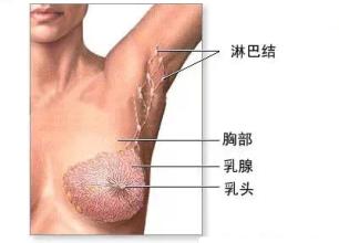 腋下淋巴结肿大医生建议不用管,因为淋巴肿大去医院