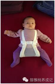 大腿纹不对称图片大全,新生儿大腿皮纹不对称怎么办