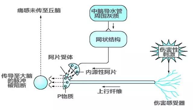 聚焦颈肩腰腿疼,中度疼痛的镇痛方法