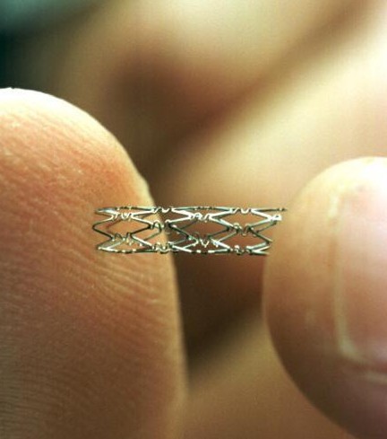 心血管支架多长时间更换,心血管球囊与支架的区别