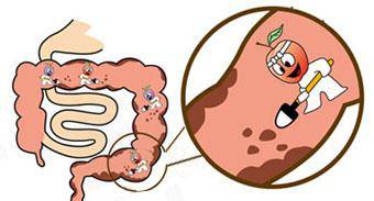 两招教你告别便秘