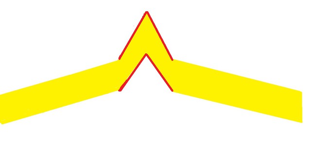 为什么要做产后盆底康复,产后两年了盆底康复还管用吗