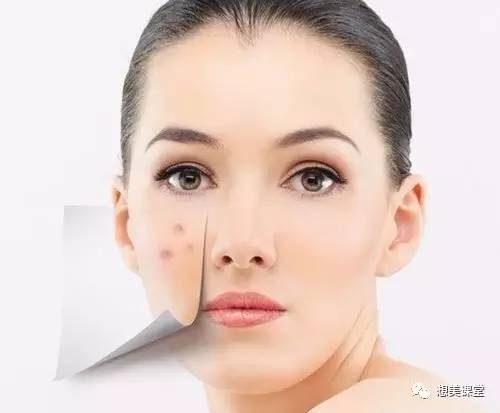 皮肤挺好的用什么护肤品,皮肤好差老是起痘痘怎么办