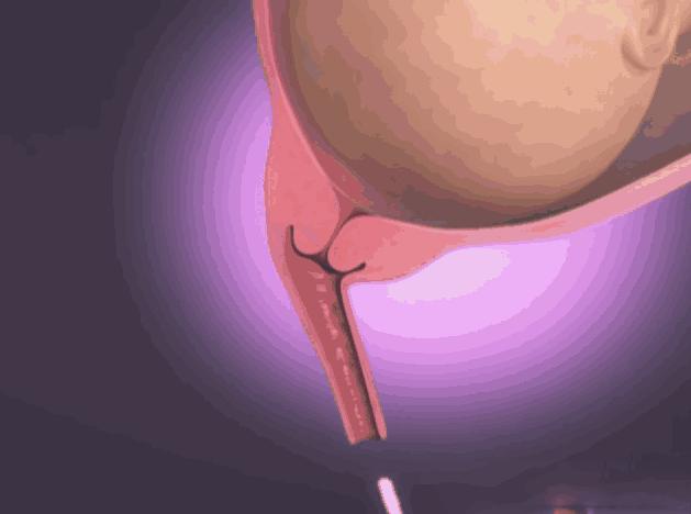 动画演示生孩子全过程，母亲的伟大你可懂？