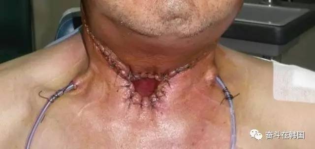 烟盒很恶心的是什么烟,烟盒特别恶心的是什么烟