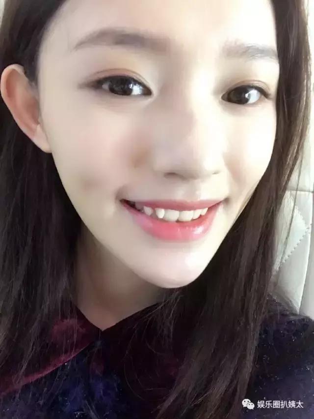 林允因换牙变脸？徐娇从假小子变小女人？星女郎现在都怎么样了？