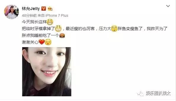 林允因换牙变脸？徐娇从假小子变小女人？星女郎现在都怎么样了？