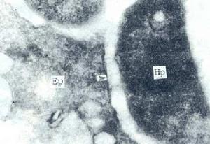 行家推荐治疗幽门螺杆菌,行家治疗幽门螺杆菌药方
