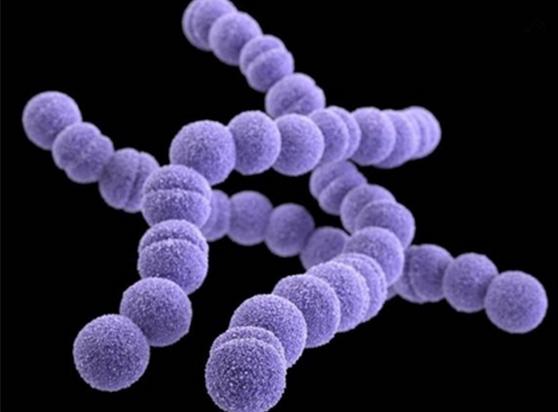 澳洲维骨力关节灵简介,维骨力治疗关节炎