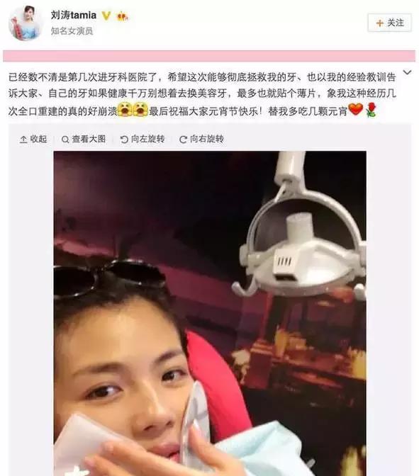 整牙=整容？看杨幂、刘涛、高圆圆为你亲身示范！