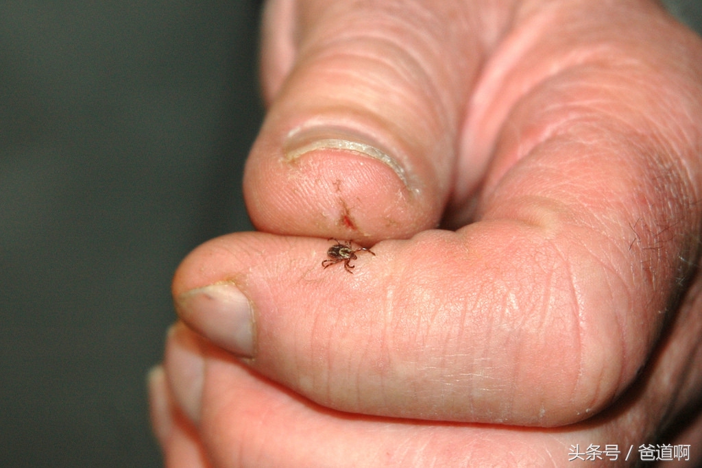 怀孕5至8周预防宝宝缺陷的方法,胎儿保护妈妈的三个方法