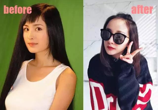 整牙=整容？看杨幂、刘涛、高圆圆为你亲身示范！