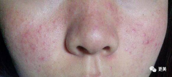 卖劣质面膜的明星,明星卖假化妆品后续