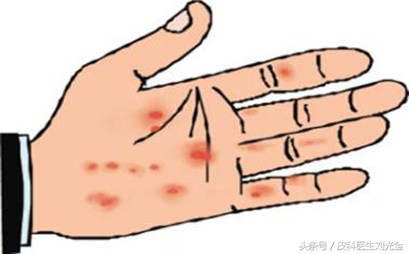 揭开谣言背后的真相,揭开麻风病村的神秘面纱