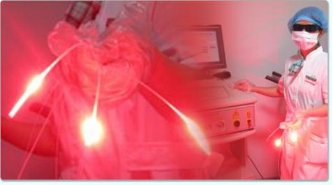 成都光动力治疗肿瘤行家有哪些,光动力治疗肿瘤的研究背景