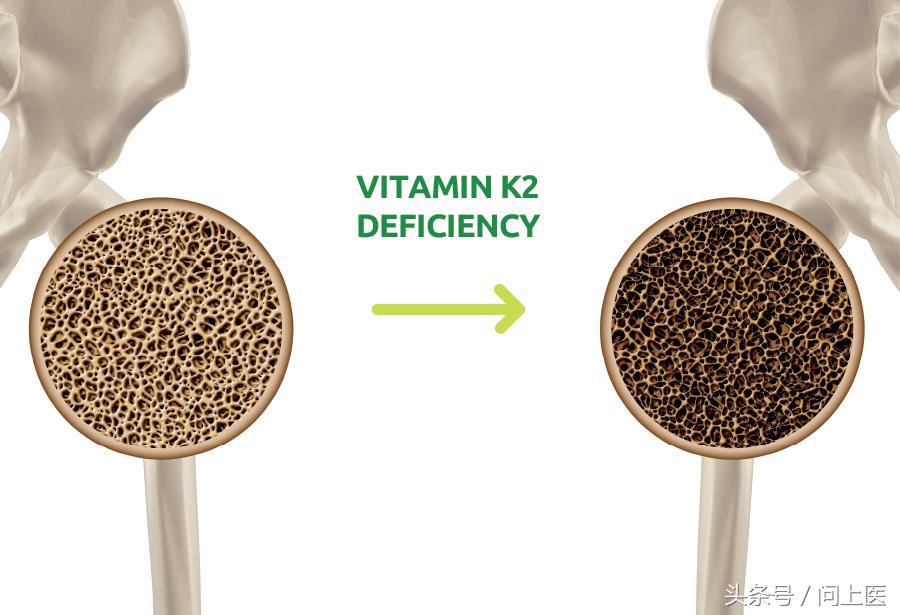 抱子甘蓝迷你小包菜做法,抱子甘蓝迷你小包菜好吃吗