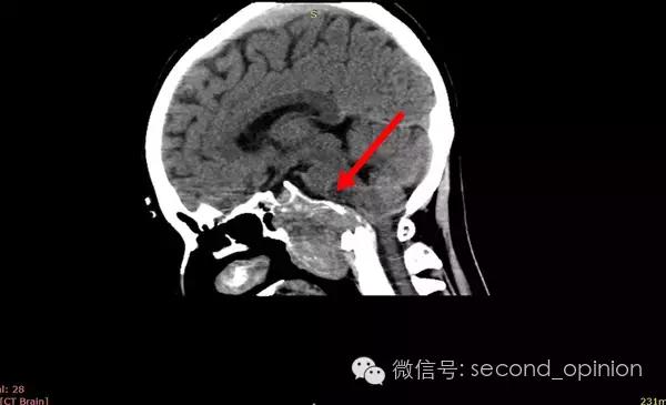 中国的质子中心有几家,全国有几所质子医院哪所最好