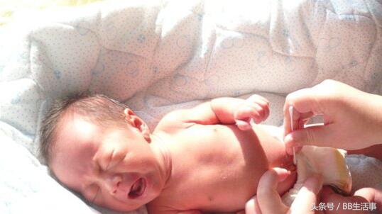 宝宝出生后“肚脐”未长好,护理不当很容易发炎!