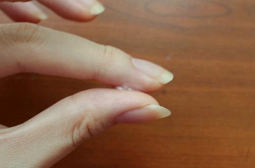 得了口腔溃疡怎么能吃辣的,口腔溃疡如何吃东西不疼