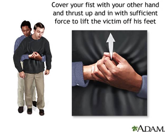 喉咙食物堵住了怎么办,食物卡住喉咙的急救方法