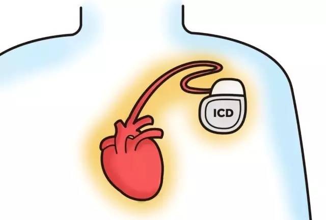心脏泵力不足会导致血压低吗,心脏泵力不足的危害