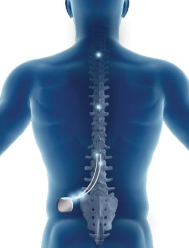 疼痛研究最新进展,疼痛阈值与疼痛的关系