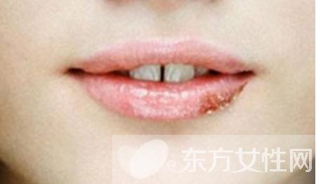 感冒嘴上起泡是什么原因,嘴上起泡是什么原因该怎么治疗