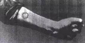 这种物质曾被当作保健成分，受害者的遗骨因此发光上千年