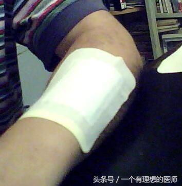 太乙膏药配方与制作方法,医用压敏热熔胶制作膏药