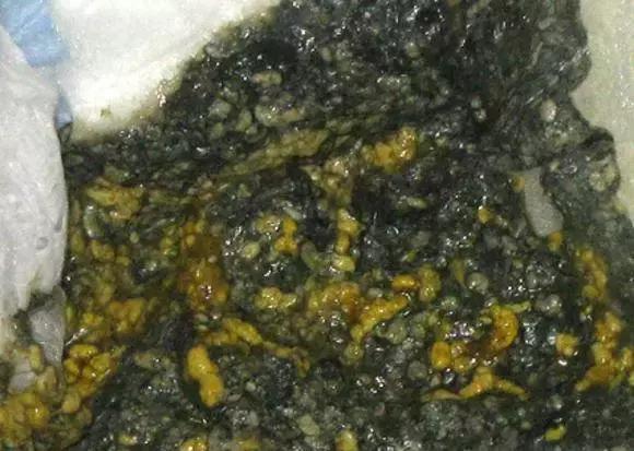 关于宝宝大便的11种性状,宝宝大便6种形状