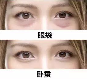 卧蚕眼袋黑眼圈傻傻分不清楚,卧蚕与眼袋别傻傻分不清楚