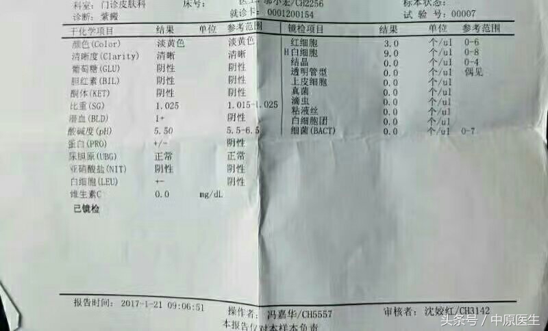 治疗紫癜用什么药会有副功能,治疗紫癜性肾炎用激素的副功能