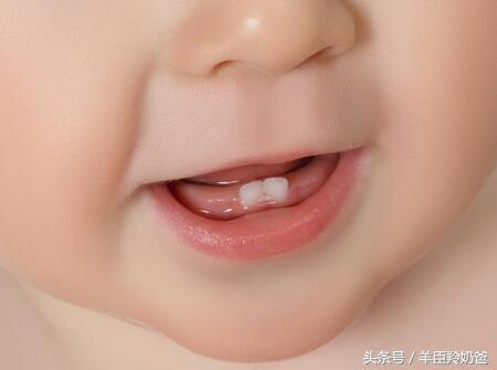 六龄齿坏了还换牙吗,怎样保护孩子的六龄齿