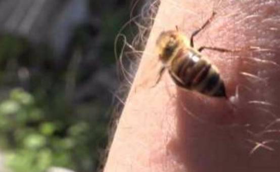 被野蜂蛰了半小时死亡,被野蜂蜇了7小时