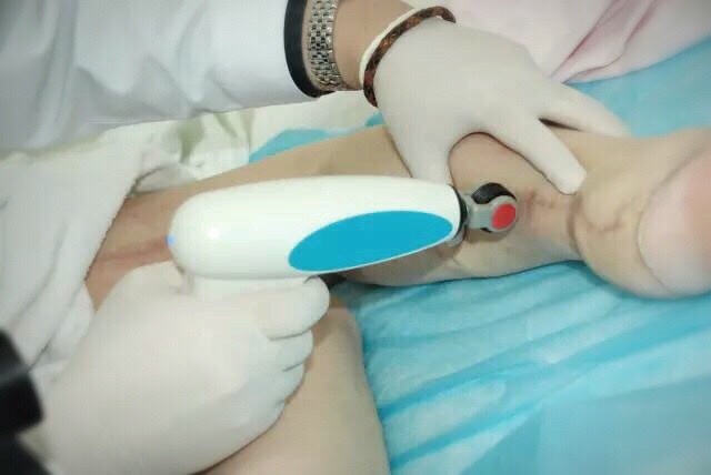 武汉治疗疤痕疙瘩哪家医院最好,疤痕疙瘩的手术治疗方法有哪些