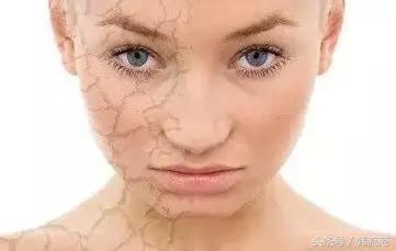 脸上起皮发痒擦睡眠面膜能改善吗,皮肤过敏能够擦洋甘菊睡眠面膜吗