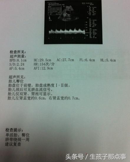 行家分享b超单的奥秘,b超单上的100个小秘密