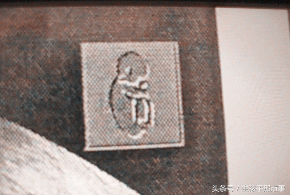 行家分享b超单的奥秘,b超单上的100个小秘密