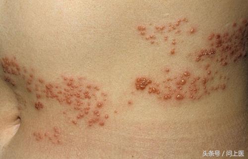 人常见的皮肤病,十二种最常见的皮肤问题对照图