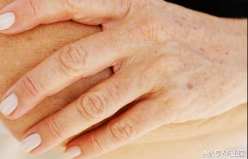 人常见的皮肤病,十二种最常见的皮肤问题对照图