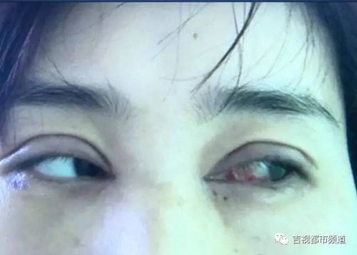 伶秀天成美容院,伶秀天成医疗美容好吗